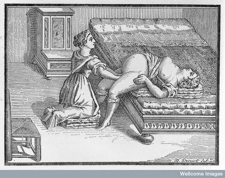 Engleman reported on Midwifery use of this open brim position in 1882. Dr. Walcher then wrote about it and it's been known by his name ever since.