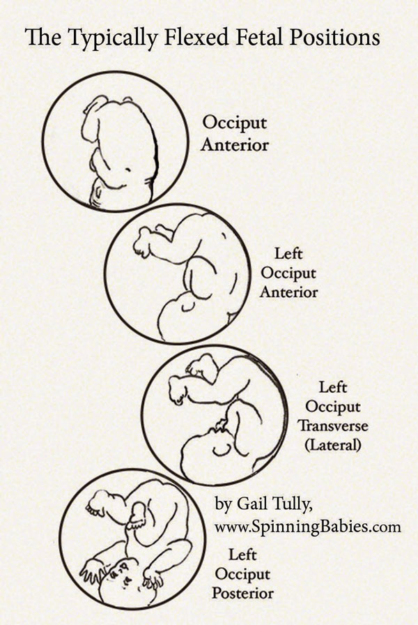 transverse baby position