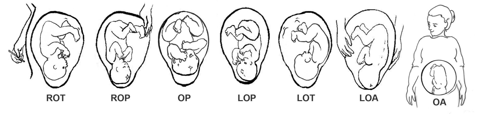 baby positions