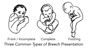 Some of the breech positions.