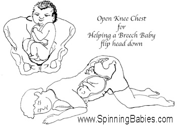 Spinning Babies Secure a board or ironing board with pillows and lean it on the couch for the angle best to back s breech baby out of the pelvis and help baby flex the head as baby is directed onto the inner fundus of the uterus.