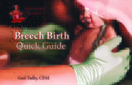 Breech Birth Quick Guide