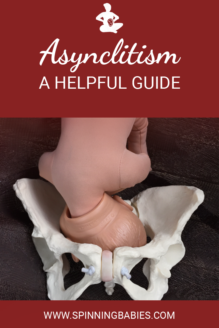 When baby’s head is tipped towards one shoulder, it has a harder time passing through the narrow part of the pelvis. Labor becomes longer, and sometimes baby doesn’t fit out the pelvis. Thankfully, we have techniques for this problem! #Childbirth #Pregnancy