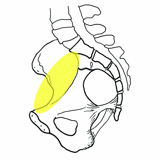 Inlet Level of the pelvis