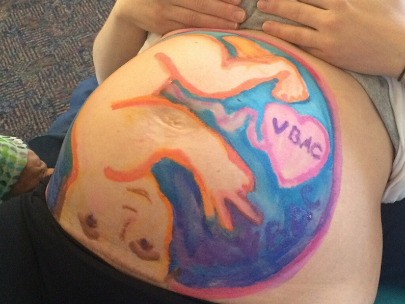 VBAC Belly Mapping