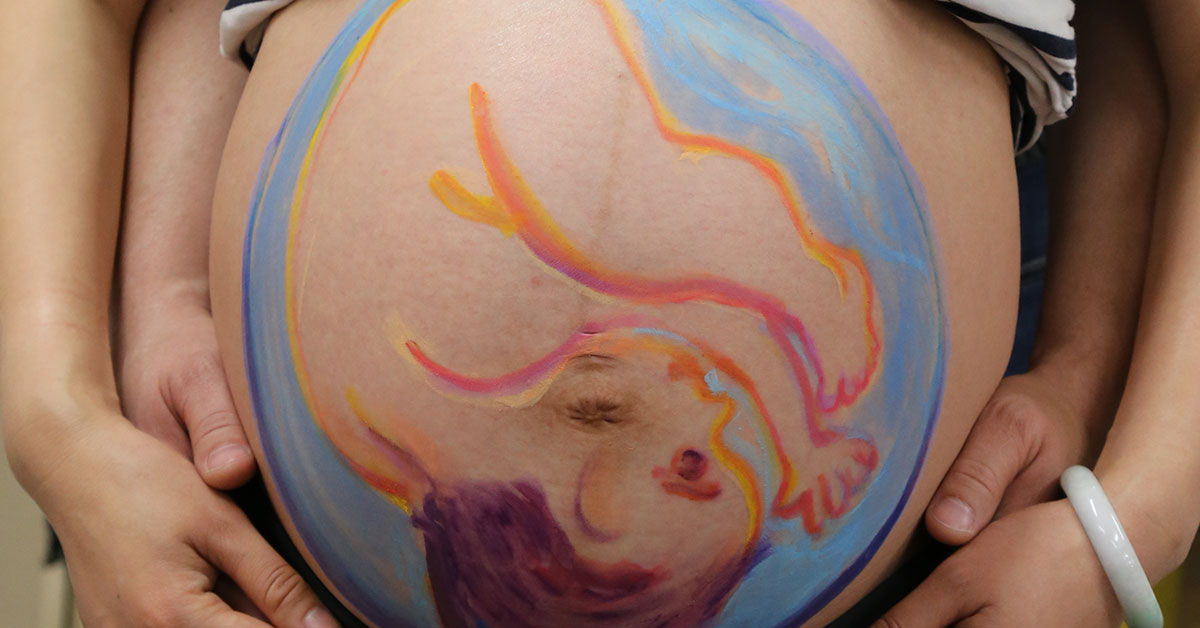 Do transverse babies usually turn picture